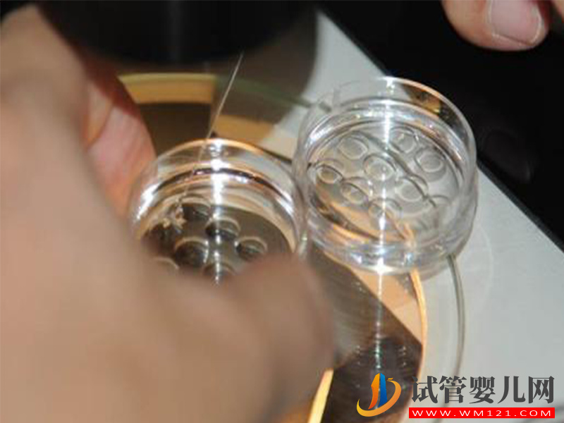 拒絕被中介忽悠，臺灣凍卵費用、流程及醫院攻略請收下(圖4)