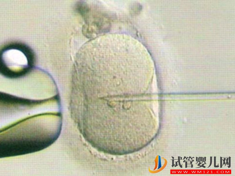 大揭秘！凍胚移植不同人群最佳時間也不一樣(圖1)