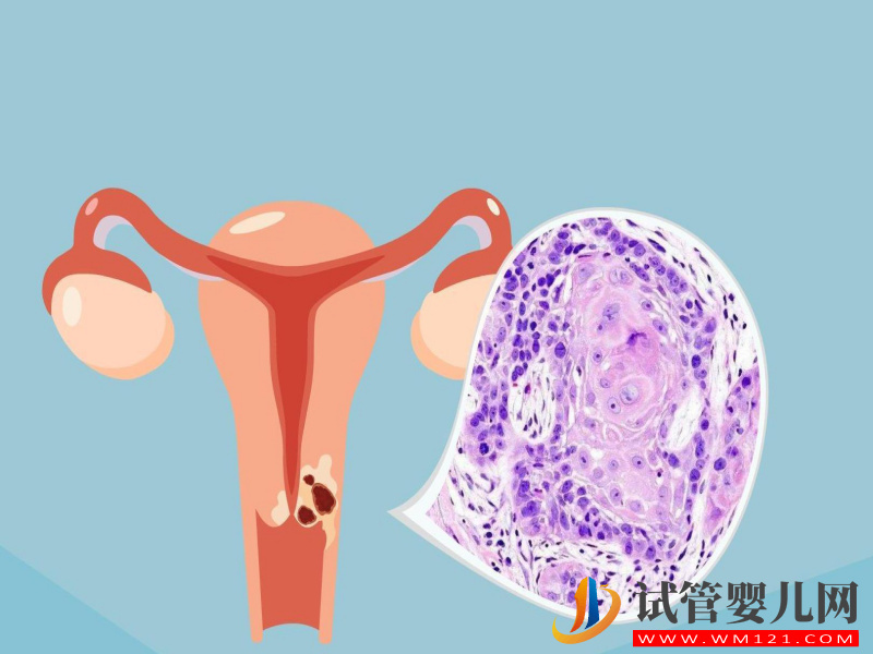 卵泡萎縮會影響試管成功率,19個卵泡懷孕幾率也很低(圖1) 卵泡萎縮會影響試管成功率,19個卵泡懷孕幾率也很低(圖1)