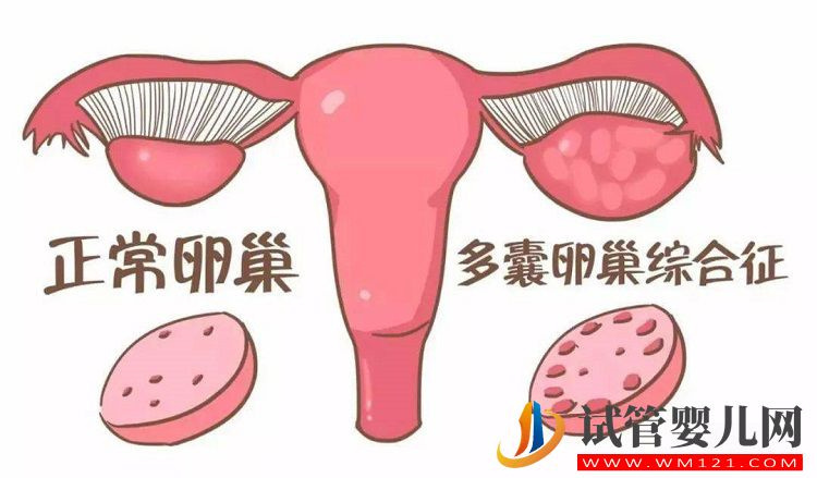 俄羅斯試管成功案例分享，帶你了解長方案具體流程(圖3)