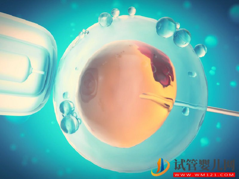 想去俄羅斯做試管，3步微刺激方案流程請查收(圖1)