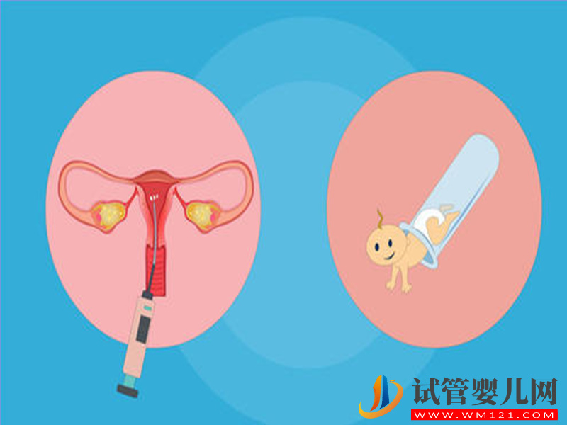 手把手教你選擇短方案與長方案，二者價格流程大不同(圖2)