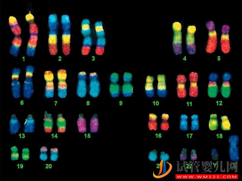 45XO染色體形成的原因及常見的癥狀介紹(圖1)