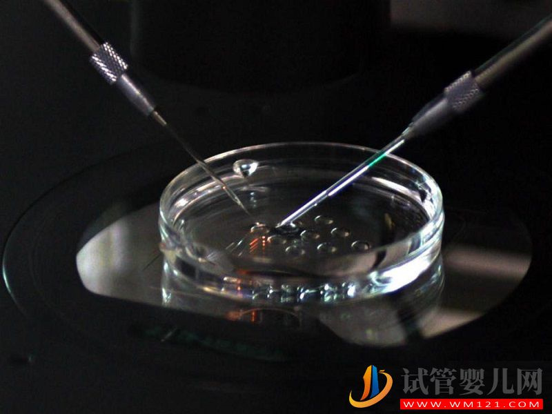 揭秘二代試管全過程，其實就是檢查、進周兩大階段(圖6)