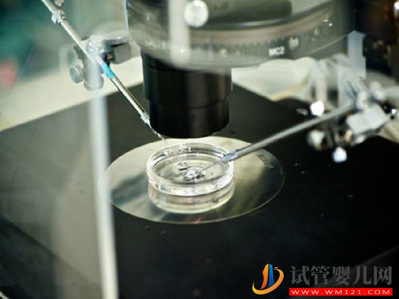 詳解第四代試管的流程，細節操作你好奇不(圖3)