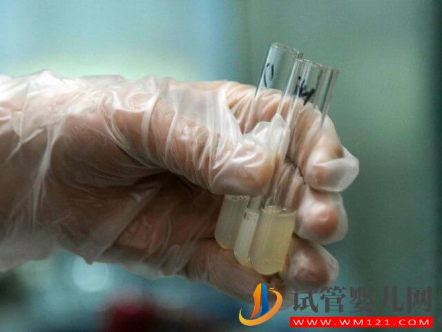 男方精子正常形態(tài)比例不大于1%能做試管嗎?(圖1) 男方精子正常形態(tài)比例不大于1%能做試管嗎?(圖1)