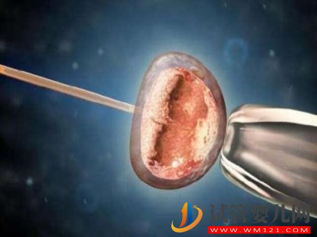 不孕不育患者做試管嬰兒一年最多可以取幾次卵？(圖1)