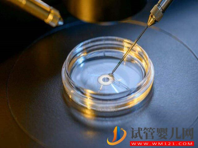 試管移植胚胎成不成功與醫生技術成熟度有關嗎？(圖1)