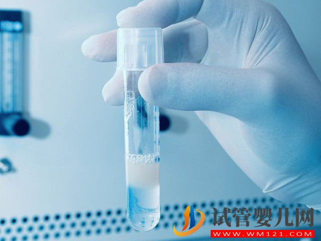 禁欲八天取出來的精子適合做試管嬰兒嗎？(圖1)