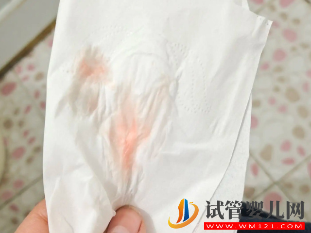 人工授精成功著床早期表現(xiàn)匯總，幫你更好的分辨是否懷孕！(圖3)