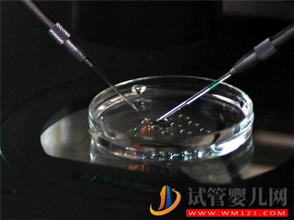天津983醫(yī)院開展第三代試管嬰兒技術(shù)了嗎?(圖1) 天津983醫(yī)院開展第三代試管嬰兒技術(shù)了嗎?(圖1)