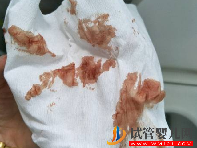 孕早期先兆性流產血呈三種顏色，往往還伴有這些癥狀(圖1)