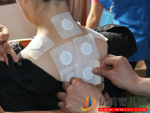 兒童三伏貼貼法示意圖,對著這份穴位表自己在家也能貼!(圖3) 兒童三伏貼貼法示意圖,對著這份穴位表自己在家也能貼!(圖3)