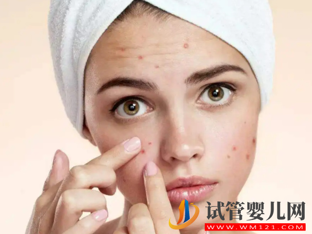 孕期容貌變化能判斷生男生女，寶媽揭露“女美娘男丑母”真相(圖1)