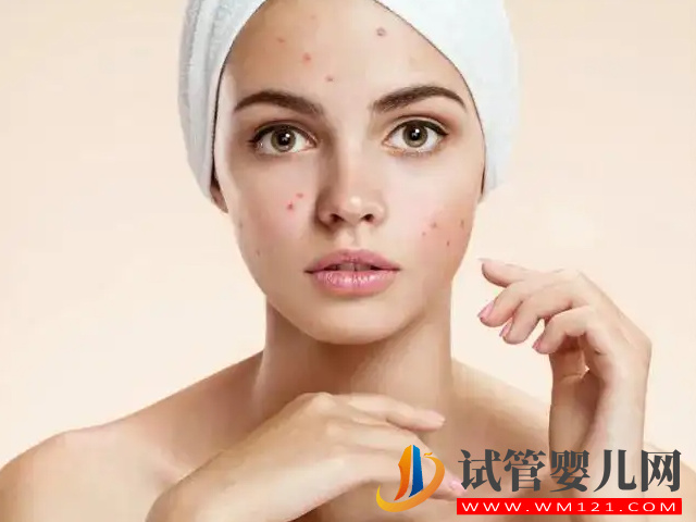 孕期容貌變化能判斷生男生女，寶媽揭露“女美娘男丑母”真相(圖2)