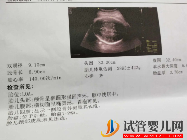 孕周與雙頂徑對照表分享，簡單一招教你分別是男是女(圖4)