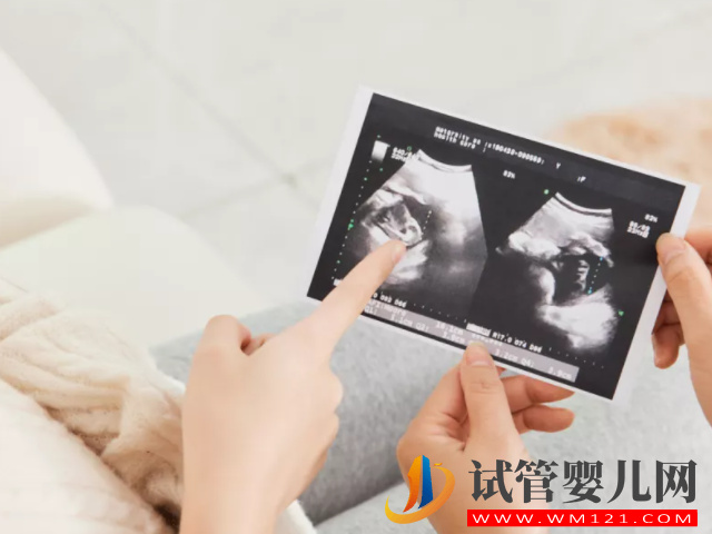 b超監測有卵黃囊基本是宮內妊娠，不管出現早晚都穩了(圖1)