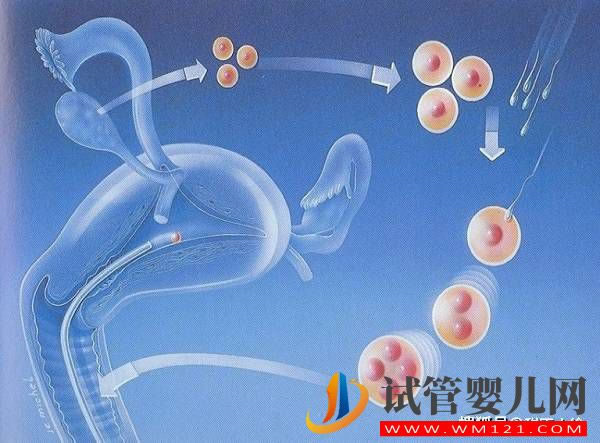 影響試管嬰兒價格的因素有哪些(圖1)