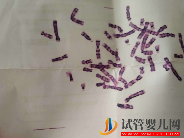 三代試管才是反復(fù)胎停的優(yōu)質(zhì)選擇,看完其中緣由就明白了(圖1) 三代試管才是反復(fù)胎停的優(yōu)質(zhì)選擇,看完其中緣由就明白了(圖1)