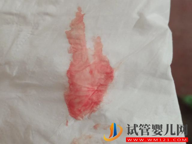 試管移植停藥后出血要警惕，小心是流產、胎停找上門！(圖2)