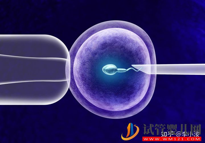 做試管嬰兒前期需要做些什么準備(圖2) 做試管嬰兒前期需要做些什么準備(圖2)