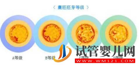 試管嬰兒多次移植不著床或生化,怎么辦(圖3) 試管嬰兒多次移植不著床或生化,怎么辦(圖3)