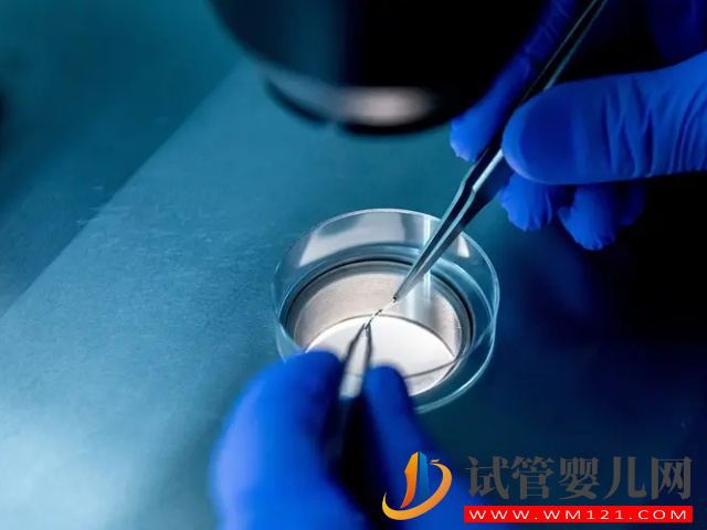 先天幼稚子宮做試管成功率評估，先治療再手術成功率翻倍(圖4)