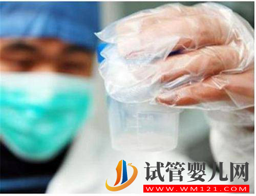 試管嬰兒男性精子需要滿足哪些條件(圖1)