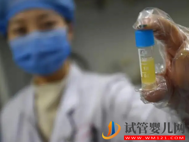 精子檢查報告單正確打開方式，看這7項主要數值就能知全貌(圖5)