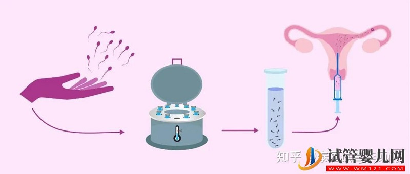 淄博試管嬰兒怎么做的全過程_試管嬰兒具體流程(圖2)