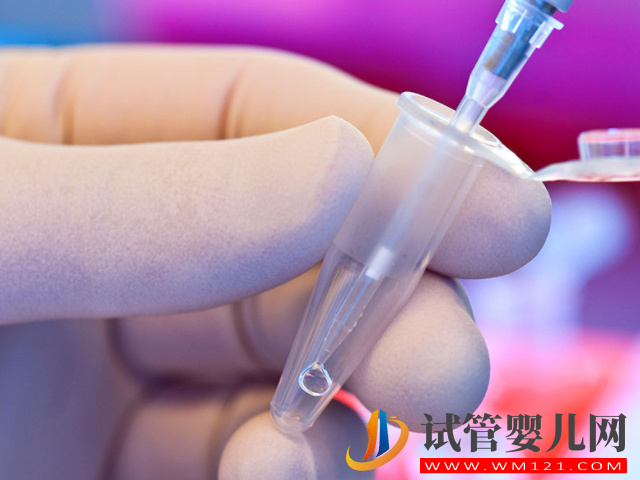 國(guó)外人工授精選擇孩子性別真相來(lái)了,看你滿足條件沒(méi)(圖1) 國(guó)外人工授精選擇孩子性別真相來(lái)了,看你滿足條件沒(méi)(圖1)