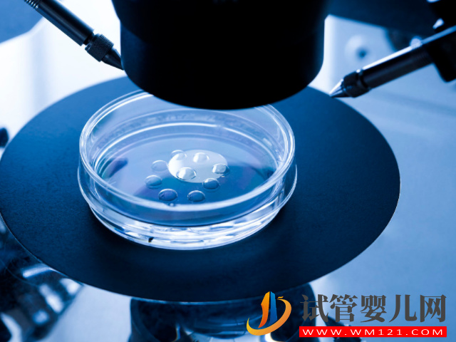 國(guó)外人工授精選擇孩子性別真相來(lái)了,看你滿足條件沒(méi)(圖2) 國(guó)外人工授精選擇孩子性別真相來(lái)了,看你滿足條件沒(méi)(圖2)