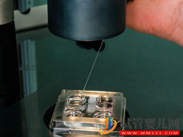 三代試管嬰兒全過程詳解，一切順利的話僅需2個月(圖3)