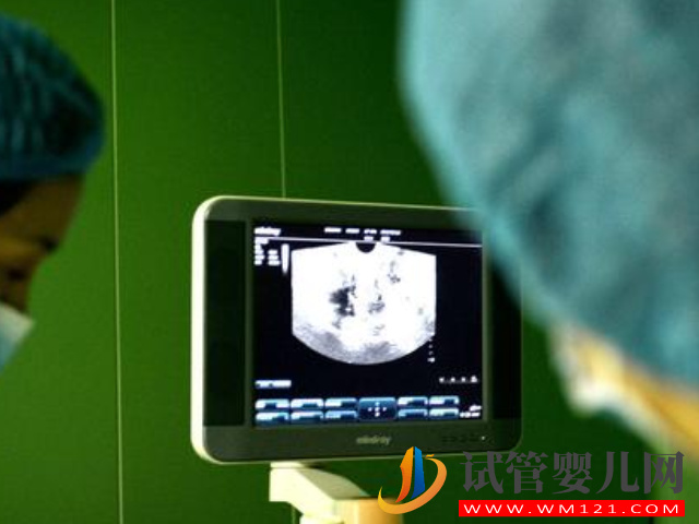 國內同志家庭生育福音，美國試管對夫妻性別無要求(圖3)