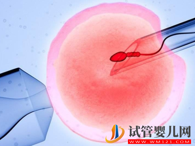 華西醫院可以為HIV做第三代試管嗎？(圖1)