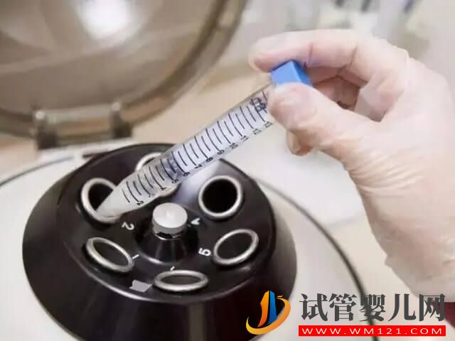 在青島做一次試管嬰兒移植的費用大約多少？(圖2)