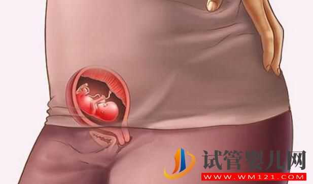 試管嬰兒移植后早期著床有什么反應呢(圖3) 試管嬰兒移植后早期著床有什么反應呢(圖3)