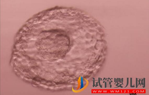 試管嬰兒養(yǎng)囊胚是什么樣的?什么樣的囊胚質(zhì)量好?(圖2) 試管嬰兒養(yǎng)囊胚是什么樣的?什么樣的囊胚質(zhì)量好?(圖2)