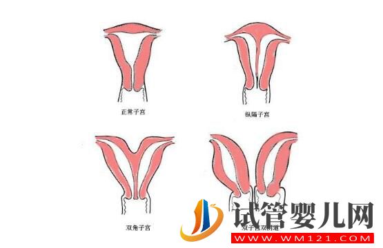 子宮偏小的女性做試管嬰兒?jiǎn)?？?lái)看看吧(圖1)