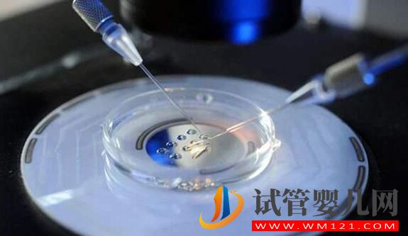 試管嬰兒促排不會選擇方案 一文加深你對促排卵方案的了(圖5) 試管嬰兒促排不會選擇方案 一文加深你對促排卵方案的了(圖5)