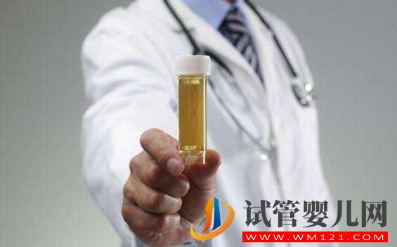 試管嬰兒檢查報告有效期是多長?各項檢查都一樣嗎(圖3) 試管嬰兒檢查報告有效期是多長?各項檢查都一樣嗎(圖3)