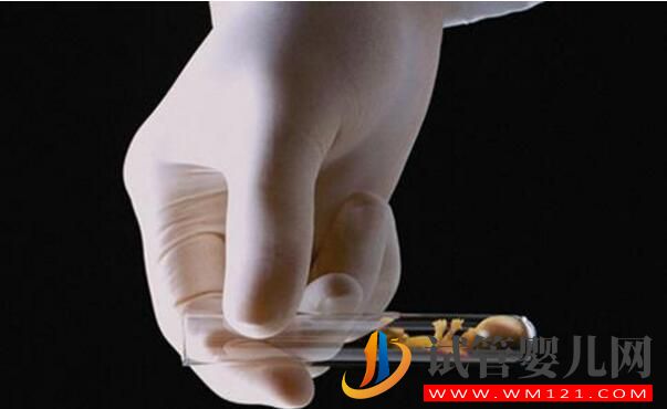 試管嬰兒雙胞胎的幾率有多大,費(fèi)用一樣嗎?(圖3) 試管嬰兒雙胞胎的幾率有多大,費(fèi)用一樣嗎?(圖3)