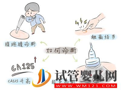 子宮內(nèi)膜異位癥——痛經(jīng)的一種常見(jiàn)病因(圖4)
