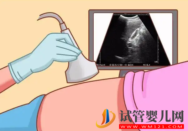 移植尿憋尿誤區一定要看！憋太多不會影響胚胎著床成功(圖1)