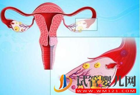 卵巢早衰怎樣調(diào)理做試管？(圖1)