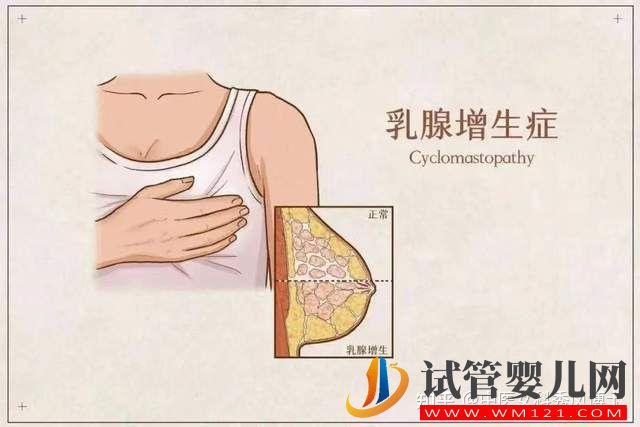 絕經來臨前,身體出現這些癥狀,一定不能忽視!(圖1)