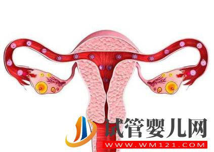 那些因素會造成卵巢不孕?(圖1)