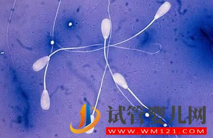 試管嬰兒的流程是怎樣的？需要做什么準(zhǔn)備？要注意什么？(圖3)