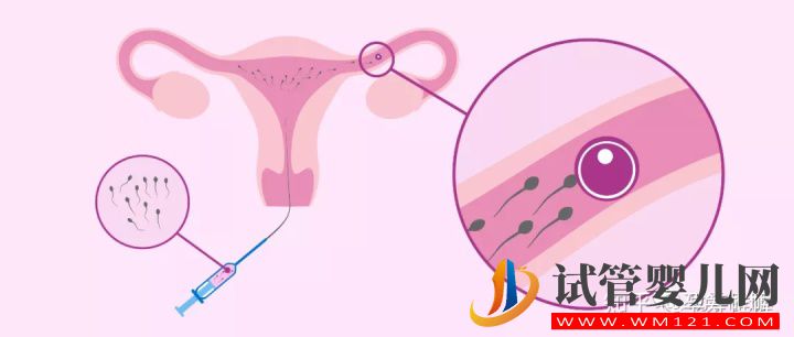 一篇文章看懂輔助生殖(圖3) 一篇文章看懂輔助生殖(圖3)