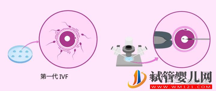一篇文章看懂輔助生殖(圖6) 一篇文章看懂輔助生殖(圖6)